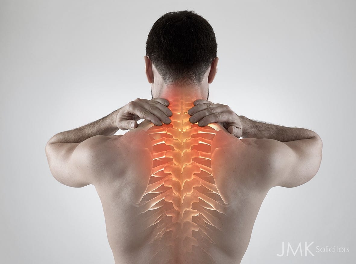 the importance of rehab after an accident jmk solicitors